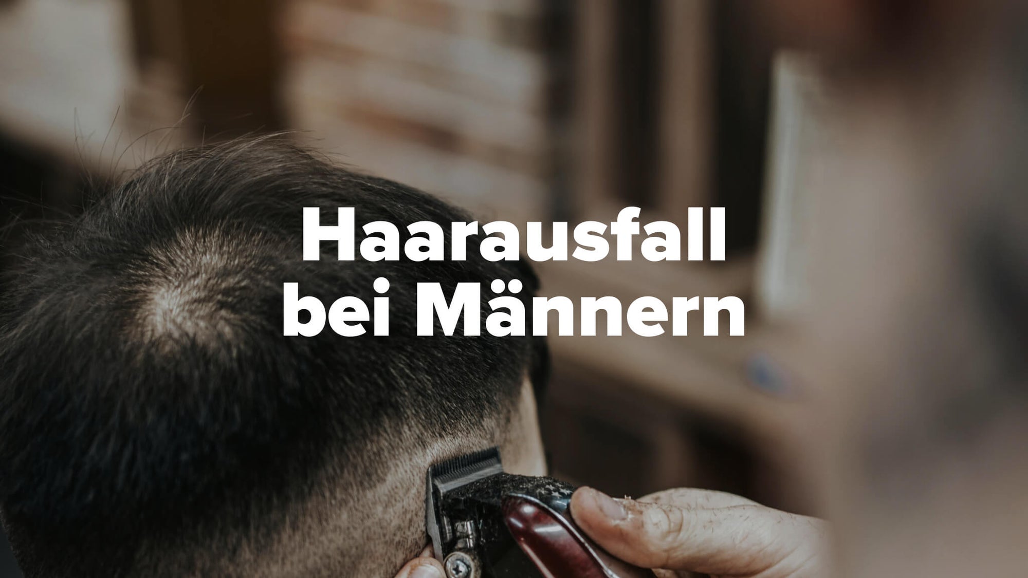 Haarausfall bei Männern